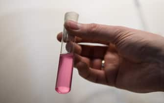 The head of the national reference centre for invasive fungal infections, Oliver Kurzai, holding a sample of a yeast fungus in a test tube with a colour indicator at a laboratory of the University of Wuerzburg in Wuerzburg, Germany, 23 January 2018. In Germany, an the number of patients suffering from the dangerous yeast infection Candida auris is rising. Photo: Nicolas Armer/dpa (Photo by Nicolas Armer/picture alliance via Getty Images)