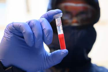 A French firefighter from Marins Pompiers unit of Marseille wearing protective equipment shows a test tube as he working at the PCR machine on a mobile unit, which can detect the presence of SARS-CoV-2 in the environment after prelevment in Marseille on 03 April, 2020, during the strict lockdown in France to stop the spread of the novel coronavirus. - Already capable of fighting the threat of bioterrorism and poisons like anthrax, the Marseille firefighters are now hunting another adversary, the SARS-CoV-2, a virus that has killed nearly 55,000 people worldwide. (Photo by Christophe SIMON / AFP) (Photo by CHRISTOPHE SIMON/AFP via Getty Images)