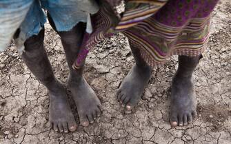 A boy and a girl, both malnourished, are standing barefooted in a dry riverbed in Nsanje District, southern Malawi, Africa, illustrating the effects of El Nino, the worst drought and food crisis in Africa in years.