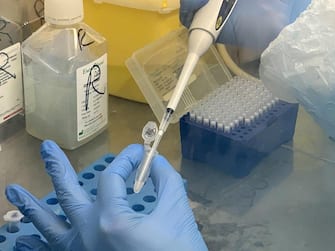 Test rapido salivare per il coranavirus