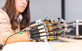 Mechanical exoskeleton hand. Physiotherapy in a modern hospital: Detail of the robotic hand in rehabilitation exercises, woman starting the exercise. Scientists, engineers and physiotherapy rehabilitation doctors use a tablet to help