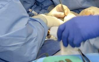 Intervento chirurgico in sala operatoria