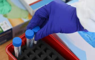 epa08628318 A health worker handles a sample tube at a COVID-19 test station in Deggendorf, Germany, 27 August 2020. In its efforts to control the ongoing pandemic of the COVID-19 disease caused by the SARS-CoV-2 coronavirus, Bavaria is installing a network of coronavirus test stations in all of its 71 districts and 25 free cities.  EPA/PHILIPP GUELLAND