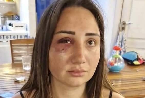 gaia vittima del pestaggio dall ex marito a pozzuoli sono una sopravvissuta 