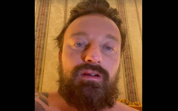 Francesco Facchinetti racconta su Instagram l'aggressione subita dal lottatore irlandese Conor McGregor