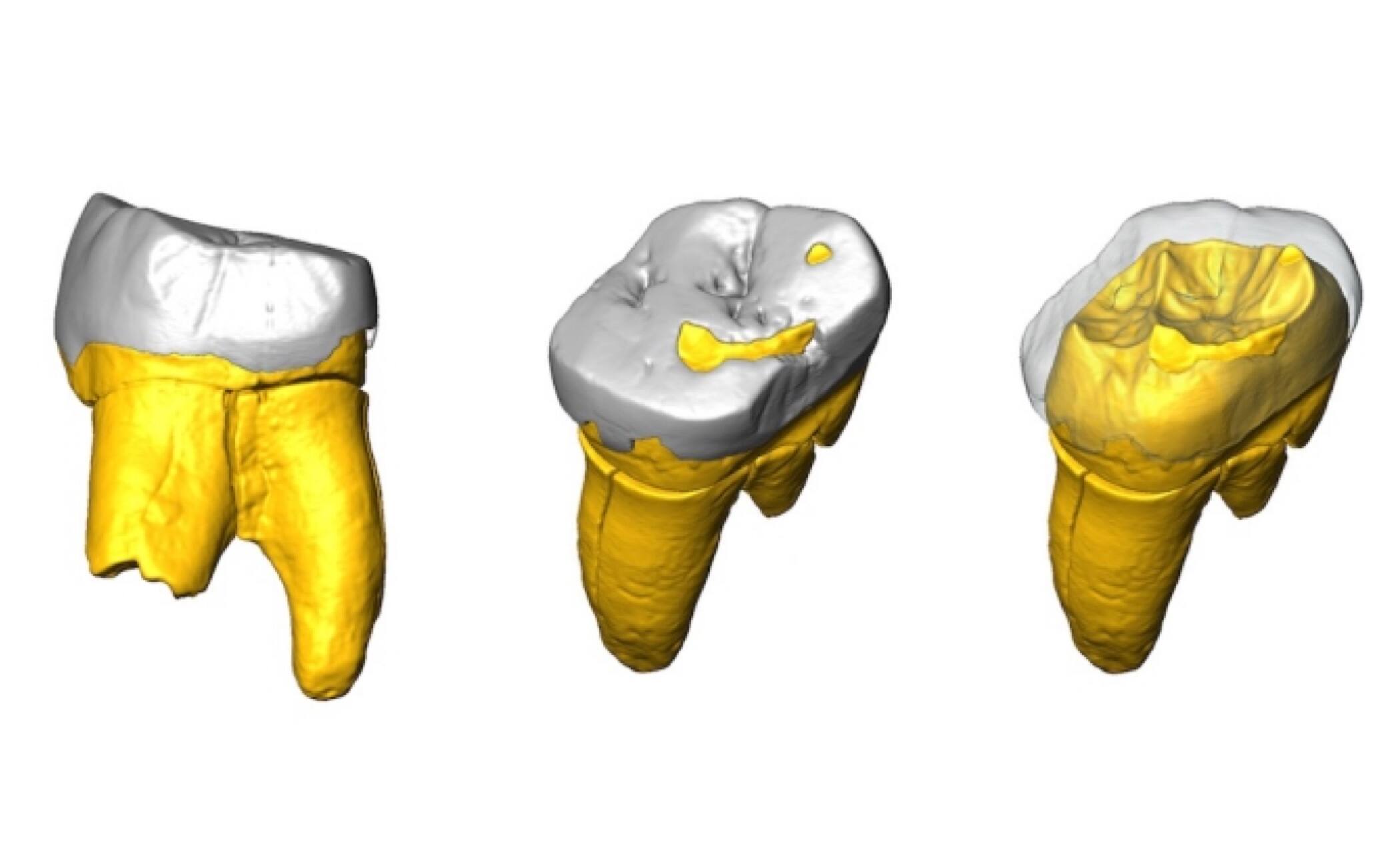 Ricostruzione 3D del dente molare Stajnia S5000