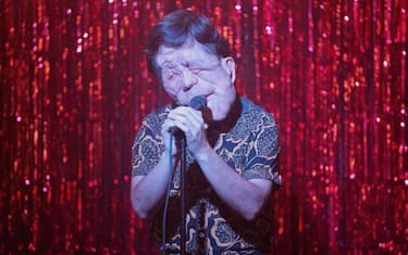 Adam Pearson interpreta Oswald in A Different Man