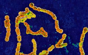 Streptococcus pyogenes A. Bacteria responsible for skin infections, impetigo, abscesses and bronchial-pulmonary infections. Seen under optical microscopy X 1000. (Photo by: BSIP/Universal Images Group via Getty Images)