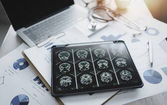 Close-up of a digital tablet with brain x-ray on screen.