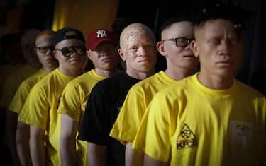 epa07200599 Albino men stand in line as they rehearse for their show prior to the Mr. & Miss Albinism East Africa contest in Nairobi, Kenya, 30 November 2018. Hudreds of albino men, women and children participated in the contest to raise awareness on discrimination and stigma against albinism in the region.  EPA/DAI KUROKAWA