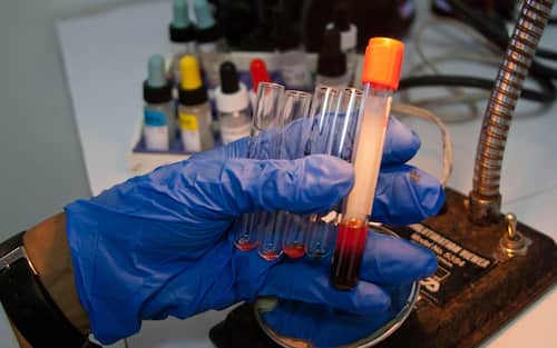 CARACAS, VENEZUELA - JUNE 14: A health worker analyzes volunteers' blood samples in test tubes during the 'World Blood Donor Day' at the Caracas Municipal Blood Bank amid the coronavirus pandemic, on June 14, 2021 in Caracas, Venezuela.