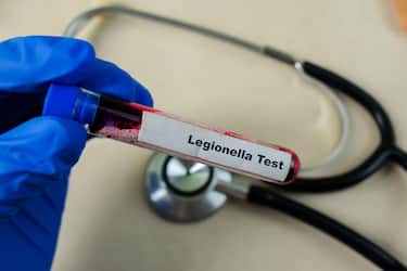 Legionella Test with blood sample on wooden background. Healthcare or medical concept