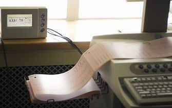 Electrocardiogram recording of patients cardiac cycle produced by electrocardiograph, visual monitoring equipment in background (Photo by Universal Images Group via Getty Images)