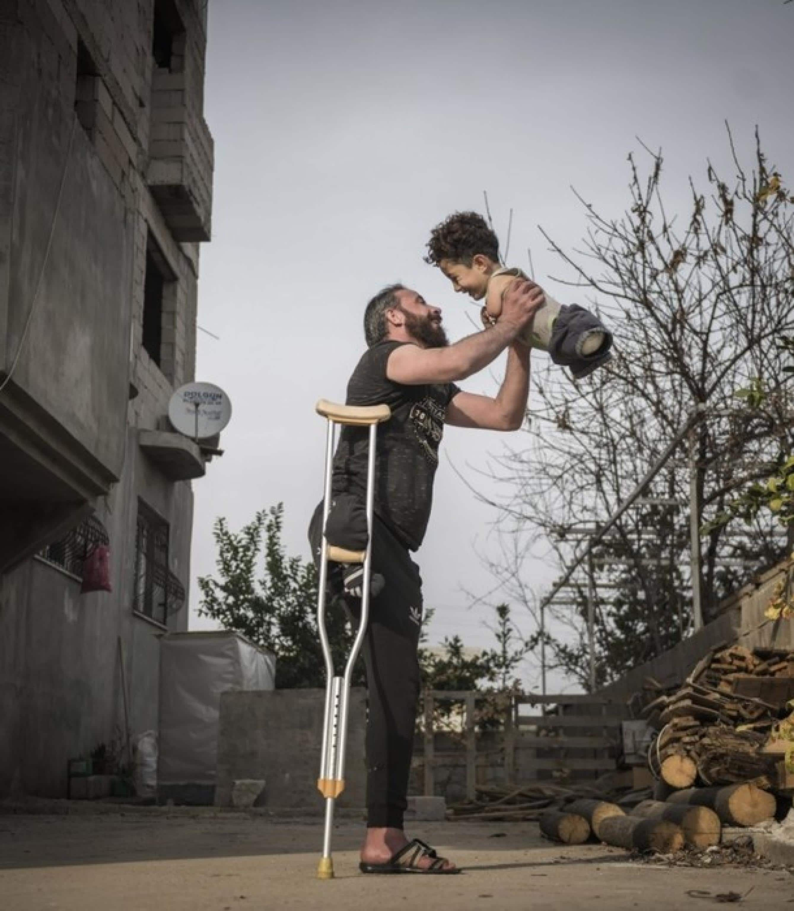 Un bambino siriano di 5 anni, nato senza braccia e gambe, immortalato sorridente con il padre, mutilato di una gamba, in uno scatto simbolo delle tragedie del conflitto in Siria, 24 ottobre 2021. La fotografia ha vinto il Siena International photo awards (Sipa) 2021. ANSA/ UFFICIO STAMPA ++HO - NO SALES EDITORIAL USE ONLY++