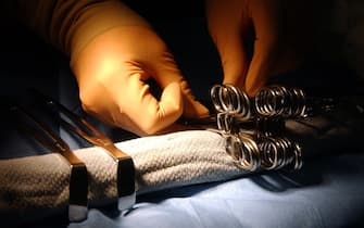 Intervento chirurgico in sala operatoria