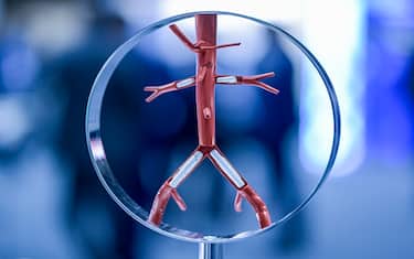 25 September 2019, Hamburg: The model of cardiovascular vessels in which so-called stents are inserted is exhibited at a congress of vascular surgeons. Photo: Axel Heimken/dpa (Photo by Axel Heimken/picture alliance via Getty Images)