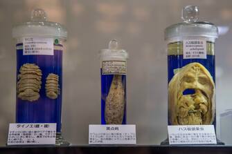 MEGURO, TOKYO, JAPAN - 2017/06/22: The Meguro Parasitological Museum is the only place in the world entirely devoted to parasites, and it has become a popular offbeat attraction with over 45,000 specimens in its collection. The prize attraction is the worlds longest tapeworm. (Photo by John S Lander/LightRocket via Getty Images)