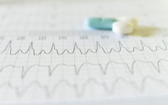 White, blue and light blue pills on an electrocardiogram paper. Medications for cardiac patients. Heartbeats recorded on paper.