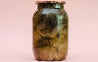 Botulism, food poisoning from canned foods concept. Glass jar wi