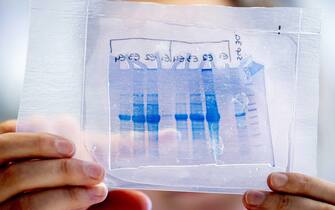 NETHERLANDS MEDICAL CENTER DEVELOPS VACCINE