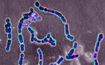 Streptococcus pyogenes A. Bacteria responsible for skin infections, impetigo, abscesses and bronchial-pulmonary infections. Seen under optical microscopy X 1000. (Photo by: BSIP/Universal Images Group via Getty Images)