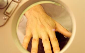 Una visita dermatologica a una mano