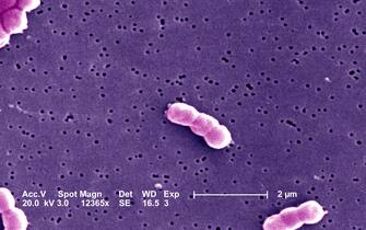L’Acinetobacter baumannii