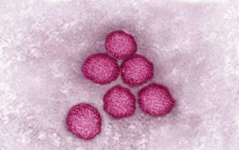 west nile virus