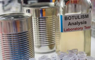 botulismo alimentare