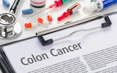The diagnosis Colon Cancer written on a clipboard
