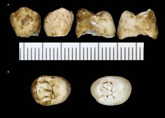 General View (Researchers Announce Discovery of Ancient Skull and Teeth in South Africa)