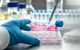 Scientist pipetting medical samples into microplate in laboratory