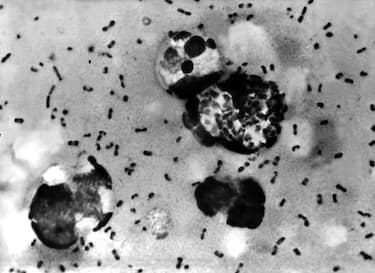 UNDATED PHOTO:  A bubonic plague smear, prepared from a lymph removed from an adenopathic lymph node, or bubo, of a plague patient, demonstrates the presence of the Yersinia pestis bacteria that causes the plague in this undated photo. The FBI has confirmed that about 30 vials that may contain bacteria that could cause bubonic or pneumonic plague have gone missing, then found, from the Health Sciences Center at Texas Tech University January 15, 2003 in Lubbock, Texas. The plague, considered a likely bioterror agent since it's easy to make, is easily treatable with antibiotics if diagnosed early and properly.  (Photo by Centers for Disease Control and Prevention/Getty Images)