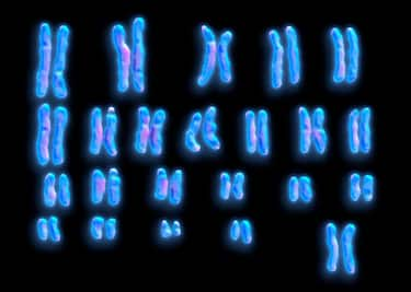 Human chromosomes