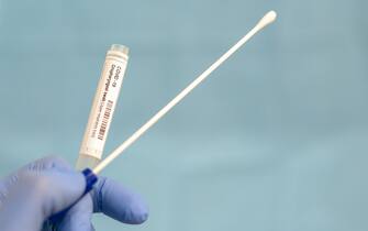 Most tests for the new strain of coronavirus involve taking a swab sample for analysis