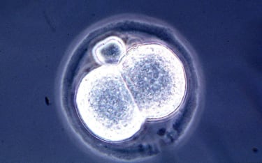 Microscopic View Of A Two Cell Mouse Embryo, A Result Of A New And Relatively Simple Cloning Technique Discovered By Scientists At The University Of Hawaii July 1998. The Scientists Have Created Dozens Of Cloned Mice, Marking The First Documented Cloning Of Adult Mammals Since Researchers In Scotland Announced The Birth Of Dolly The Sheep Last Year.  (Photo By Getty Images)