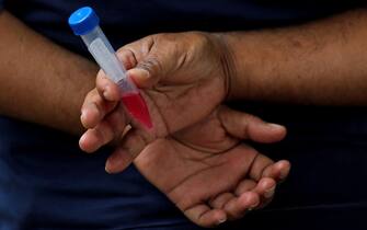 epa09025411 A man holds a sample tube during the COVID-19 test in Bangalore, India, 20  February 2021. Bruhat Bengaluru Mahanagara Palike (BBMP) Commissioner N. Manjunath Prasad said around 50,000 tests are being conducted daily in the city. Health authorities reported a spike in positive cases over the past week.  EPA/JAGADEESH NV