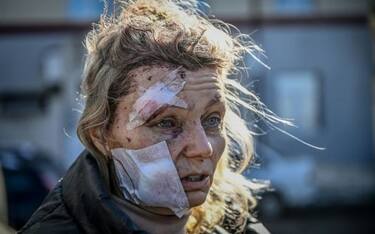 TOPSHOT - (COMBO) This combination of photographs created on February 15, 2023, shows a file photograph of Olena Kurylo, a 52-year-old Ukranian teacher (L) as she stands outside a hospital after the bombing of the eastern Ukraine town of Chuguiv on February 24, 2022 and Olena Kurylo (L) as she looks on during an AFP interview in Katowice on February 6, 2023. - One year after photographs of her bloody face and bandaged head became early symbols of Russia's invasion of Ukraine, Olena Kurylo vividly remembers the devastating events of February 24, 2022.
A teacher at the time, now a refugee, she dreams of home. (Photo by Aris Messinis and Wojtek RADWANSKI / AFP) (Photo by ARIS MESSINIS,WOJTEK RADWANSKI/AFP via Getty Images)