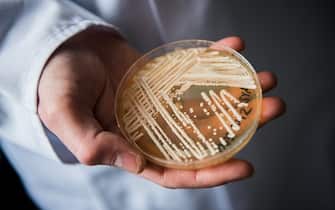 The director of the National Reference Centre for Invasive Fungus Infections, Oliver Kurzai, holding in his hands a petri dish holding the yeast candida auris in a laboratory of Wuerzburg University in Wuerzburg, Germany, 23 January 2018. There has been a recent rise of cases in Germany of seriously ill patients becoming infected with the dangerous yeast candida auris. Photo: Nicolas Armer/dpa (Photo by Nicolas Armer/picture alliance via Getty Images)