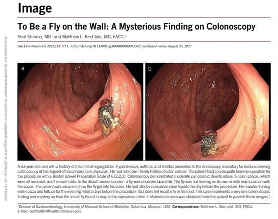 La mosca trovata nell'intestino del paziente