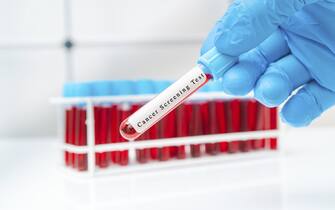Colon cancer blood test, conceptual image.