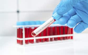 Colon cancer blood test, conceptual image.