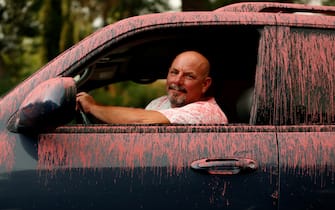 SANTA CLARITA, CA - JULY 24, 2016: Rob Chauvie, 50, says he was helping his sister evacuate during the Sand fire, and was hit by Phos-Chek, in  Santa Clarita, CA  July 23, 2016.   (Francine Orr/ Los Angeles Times)