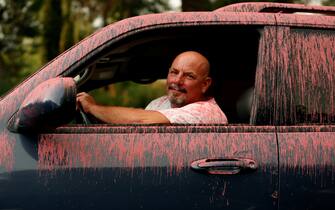 Los Angeles SANTA CLARITA, CA - JULY 24, 2016: Rob Chauvie, 50, says he was helping his sister evacuate during the Sand fire, and was hit by Phos-Chek, in Santa Clarita, CA July 23, 2016. (Francine Orr/ Los Angeles Times)