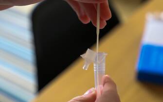 analisi test covid