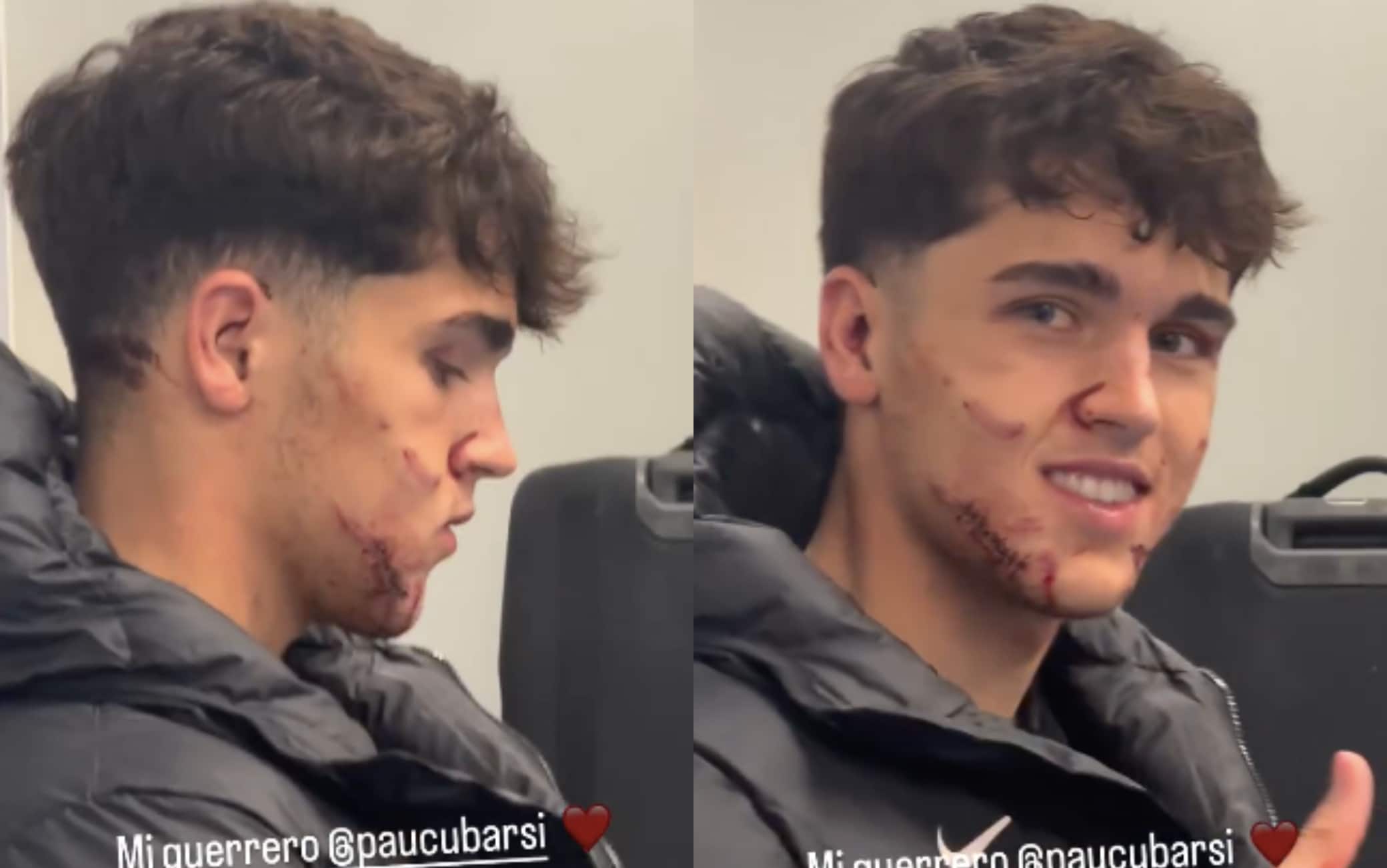 Punti, ferita e sorriso: il post social di Gavi dopo la partita per l'amico Cubarsì