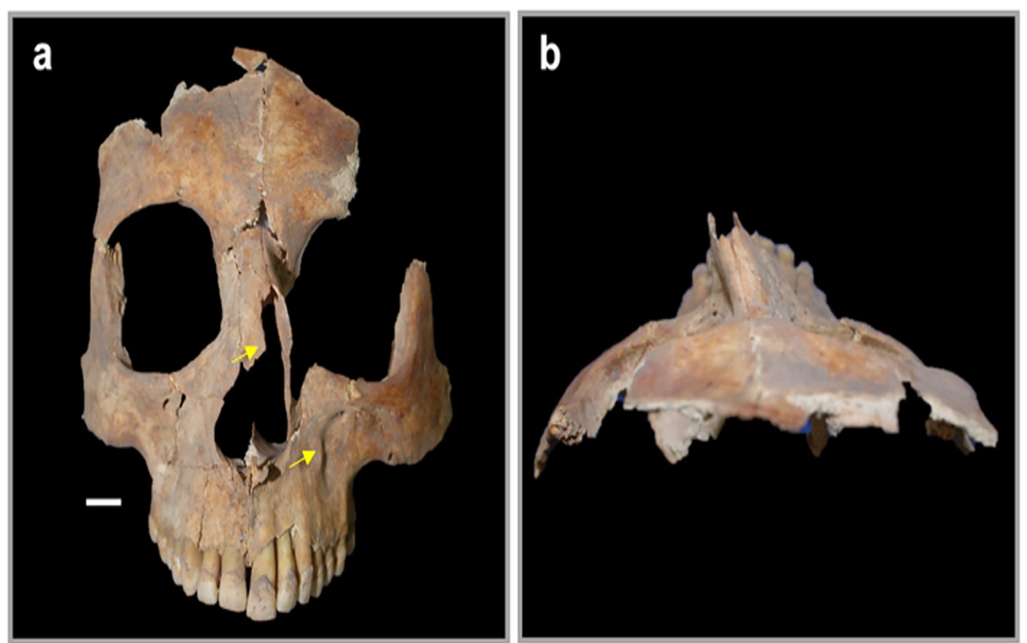 Dettaglio del cranio operato