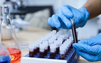 Blood research,Scientist hand holding test tube with blood in laboratory.