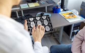 Close-up of doctor's hands pointing at brain x-rays images on a digital tablet while talking with male patient. Doctor analyzing MRI scans on a digital tablet and discussing with senior patient.