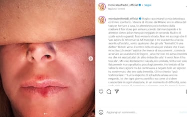 monica-leoffredi-incidente-instagram